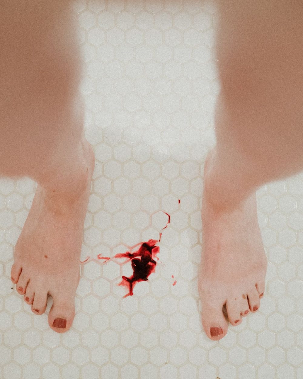A person bleeding