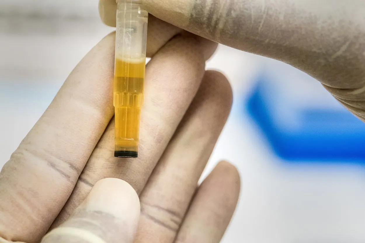 A syringe filled with urine